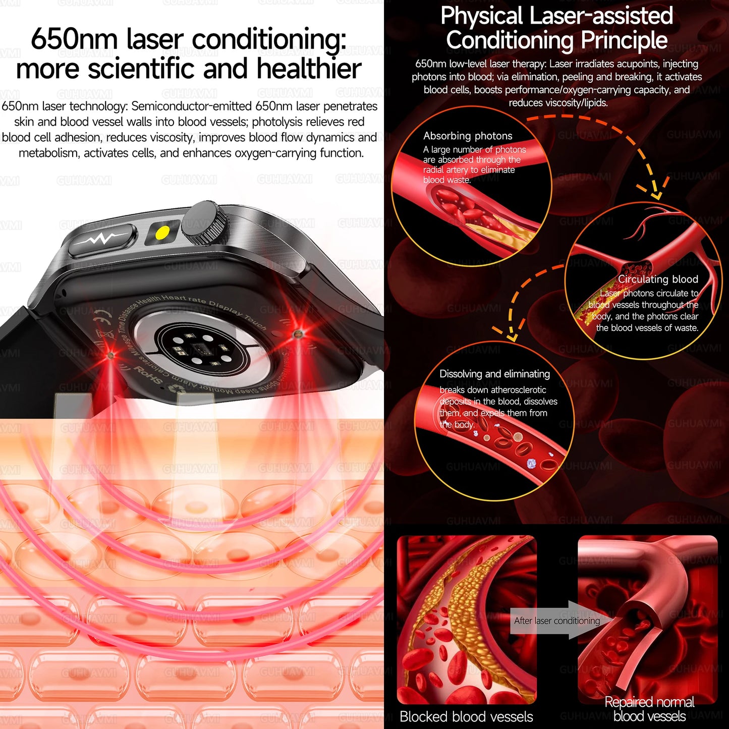 SmartWatch ECG  2026: Monitor de ECG, Terapia Láser, Control de Lípidos en Sangre y Ácido Úrico, Rastreo de Frecuencia Cardíaca y Fitness para Hombres y Mujeres